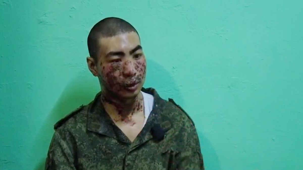 Rusové zajali českého občana bojujícího na Ukrajině. Má vážná zranění